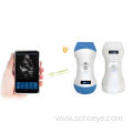 Wifi Probe ultrasound scanner